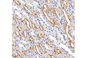 Immunohistochemistry of paraffin embedded mouse kidney using ADCY4 (ABIN7072959) at dilution of 1: 700 (400x lens) (ADCY4 antibody)