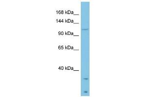 Laminin Beta 3 antibody used at 1 ug/ml to detect target protein. (Laminin beta 3 antibody  (Middle Region))