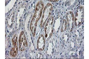 Immunohistochemical staining of paraffin-embedded Human Kidney tissue using anti-CCM2 mouse monoclonal antibody. (CCM2 antibody)