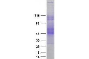 Western Blotting (WB) image for SLAM Family Member 6 (SLAMF6) (Transcript Variant 3) protein (Myc-DYKDDDDK Tag) (ABIN2713690)