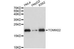 Western blot analysis of extracts of various cell lines, using TOMM22 antibody. (TOMM22 antibody)