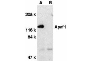 Western Blotting (WB) image for anti-Apoptotic Peptidase Activating Factor 1 (APAF1) (C-Term) antibody (ABIN1030242) (APAF1 antibody  (C-Term))