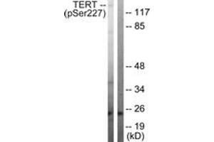 Western Blotting (WB) image for anti-Telomerase Reverse Transcriptase (TERT) (AA 196-245), (pSer227) antibody (ABIN482341) (TERT antibody  (pSer227))