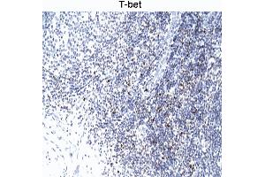 T-bet staining of human tonsil. (T-Bet antibody)
