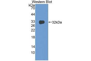 Detection of Recombinant TF, Mouse using Monoclonal Antibody to Tissue Factor (TF) (Tissue factor antibody  (AA 30-251))