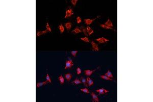 Immunofluorescence analysis of C6 cells using  antibody (ABIN7265433) at dilution of 1:100. (ADAM11 antibody  (AA 290-430))