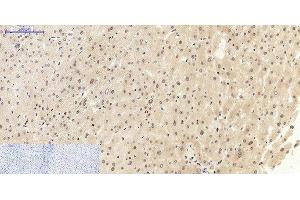 Immunohistochemistry of paraffin-embedded Human liver tissue using NFκB-p105/p50 Polyclonal Antibody at dilution of 1:200. (NFKB1 antibody)