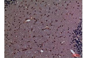 Immunohistochemistry (IHC) image for anti-Peptidylprolyl Isomerase A (Cyclophilin A) (PPIA) (Internal Region) antibody (ABIN6284334)