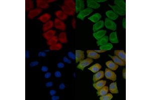 ABIN7096825 and ABIN7100891 staining Hela cells(45 min of heat-shock treatment) by IF/ICC. (CRISP1 antibody)