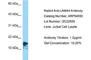 Western Blotting (WB) image for anti-Laminin, alpha 4 (LAMa4) (C-Term) antibody (ABIN2785768) (LAMa4 antibody  (C-Term))