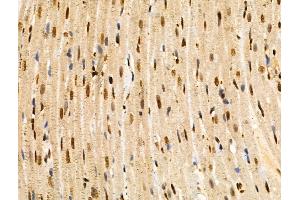 ABIN6258822 and ABIN6274418 at 1/100 staining Rat heart tissue by IHC-P.