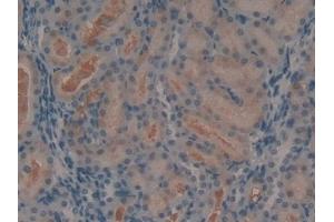 Detection of Ang1-7 in Rat Kidney Tissue using Polyclonal Antibody to Angiotensin 1-7 (Ang1-7) (Angiotensin 1-7 antibody)
