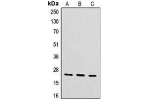 Western blot analysis of CYB561D2 expression in HeLa (A), mouse liver (B), rat kidney (C) whole cell lysates. (CYB561D2 antibody  (Center))