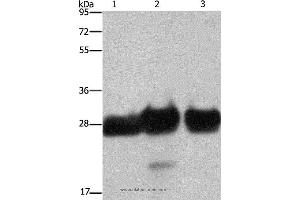 Western blot analysis of Human adrenal pheochromocytoma, fetal muscle and skeletal muscle tissue, using FHL1 Polyclonal Antibody at dilution of 1:500 (FHL1 antibody)