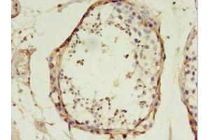 Immunohistochemistry of paraffin-embedded human testis tissue using ABIN7172467 at dilution of 1:100 (TFAM antibody  (AA 43-246))