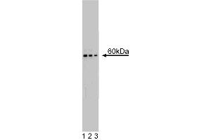 Western blot analysis of p70 [S6K] on a rat liver lysate.