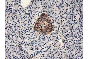 Immunohistochemical staining of paraffin-embedded Human pancreas tissue using anti-MICAL1 mouse monoclonal antibody. (MICAL1 antibody)