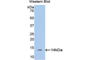 Western Blotting (WB) image for anti-Melatonin Receptor 1A (MTNR1A) (AA 216-257) antibody (ABIN1175869)