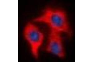 Immunofluorescent analysis of FAP alpha staining in HeLa cells. (FAP antibody)
