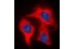 Immunofluorescent analysis of FAP alpha staining in HeLa cells.
