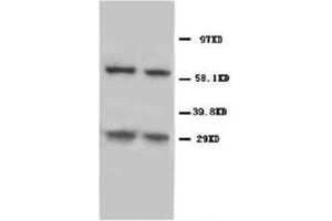 Western blot analysis of rat thymus tissue lysis using NIP3 antibody (BNIP3 antibody  (C-Term))