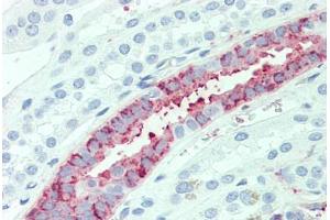 Anti-SLC4A2 antibody  ABIN1049340 IHC staining of human kidney. (SLC4A2 antibody  (N-Term))