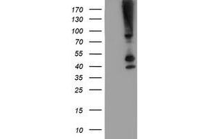 Western Blotting (WB) image for anti-serpin Peptidase Inhibitor, Clade B (Ovalbumin), Member 13 (SERPINB13) antibody (ABIN1500878) (SERPINB13 antibody)
