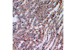 Immunohistochemical analysis of Tensin 3 staining in human kindey formalin fixed paraffin embedded tissue section. (TNS3 antibody)