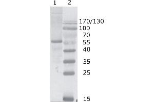 Western Blot testing of HIV-1 p24 antibody, clone N29. (HIV-1 p24 antibody  (N-Term))