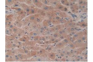 IHC-P analysis of Human Liver Tissue, with DAB staining. (HPR antibody  (AA 70-332))