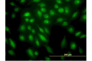 Immunofluorescence of monoclonal antibody to STK4 on HeLa cell. (STK4 antibody  (AA 391-485))