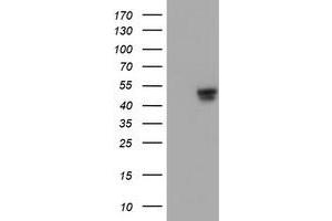 HEK293T cells were transfected with the pCMV6-ENTRY control (Left lane) or pCMV6-ENTRY C20orf3 (Right lane) cDNA for 48 hrs and lysed. (APMAP antibody)