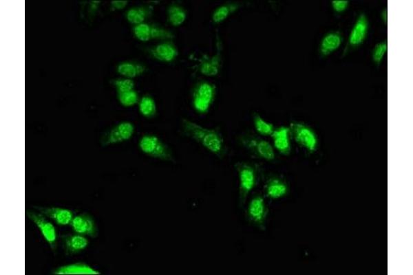 OTX1 antibody  (AA 29-244)