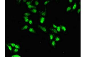 Immunofluorescent analysis of Hela cells using ABIN7155835 at dilution of 1:100 and Alexa Fluor 488-congugated AffiniPure Goat Anti-Rabbit IgG(H+L) (OTX1 antibody  (AA 29-244))