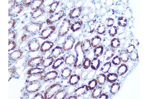 Immunohistochemistry of paraffin-embedded mouse kidney using B Rabbit mAb (ABIN7265850) at dilution of 1:100 (40x lens). (BAG3 antibody)