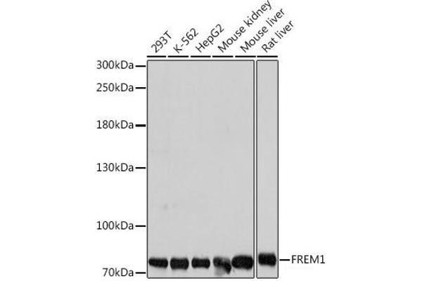 FREM1 antibody