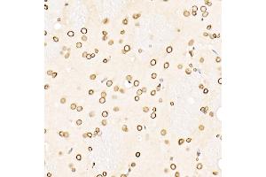 Immunohistochemistry (IHC) image for anti-Lamin B1 (LMNB1) (AA 397-586) antibody (ABIN3015698)