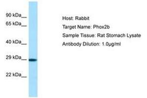 Image no. 1 for anti-Paired-Like Homeobox 2b (PHOX2B) (N-Term) antibody (ABIN6749847) (PHOX2B antibody  (N-Term))