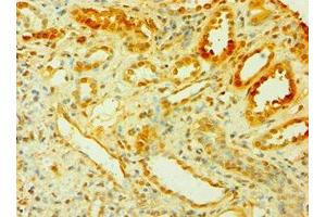 Immunohistochemistry of paraffin-embedded human kidney tissue using ABIN7149303 at dilution of 1:100 (CISH antibody  (AA 1-257))