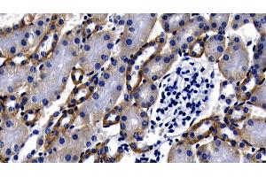 Detection of MyD88 in Mouse Kidney Tissue using Polyclonal Antibody to Myeloid Differentiation Factor 88 (MyD88) (MYD88 antibody  (AA 1-296))