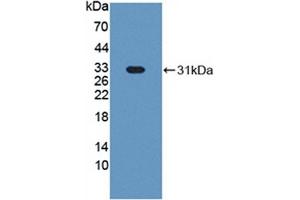 Detection of Recombinant HABP1, Bovine using Polyclonal Antibody to Complement component 1 Q subcomponent-binding protein, mitochondrial (C1QBP) (C1QBP antibody  (AA 71-278))