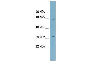 WB Suggested Anti-SRD5A2 Antibody Titration:  0.