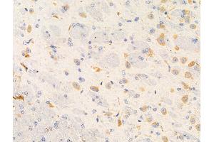 ABIN6261878 and ABIN6266545 at 1/100 staining Mouse brain tissue by IHC-P.