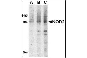 Western blot analysis of NOD2 in Jurkat cell lysate with this product at (A) 1, (B) 2 and (C) 4 μg/ml. (NOD2 antibody  (N-Term))