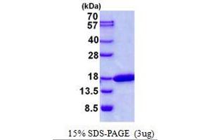 Image no. 1 for Cyclin-Dependent Kinase 2 Associated Protein 2 (CDK2AP2) protein (His tag) (ABIN1098497)
