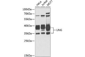 Western blot analysis of extracts of various cell lines, using UNG antibody (ABIN6133476, ABIN6149934, ABIN6149936 and ABIN6216305) at 1:1000 dilution. (UNG antibody  (AA 1-313))