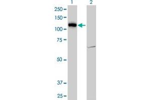 Western Blot analysis of LLGL2 expression in transfected 293T cell line by LLGL2 monoclonal antibody (M06), clone 4G2.