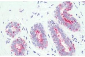 Human, Breast: Formalin-Fixed Paraffin-Embedded (FFPE) (PTGER3 antibody  (Cytoplasmic Domain))