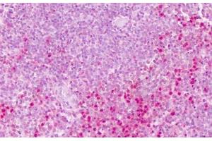Anti-PTPRE antibody IHC staining of human spleen. (PTPRE antibody  (Cytoplasmic Domain))