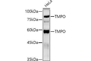 Western Blotting (WB) image for anti-Thymopoietin (TMPO) (AA 1-410) antibody (ABIN3016207)